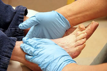 diabetic foot care and non-healing wounds treatment in the Bahamas, New Providence: Nassau (Golden Gates Estates, Palmdale, Downtown Nassau, Little Hermitage, Elizabeth Estates, Greater Chippingham, Jubilee Subdivision, Palm Cay, Carmichael Village, Adelaide, Adelaide Village, Highbury Park, Kensington Garden) areas