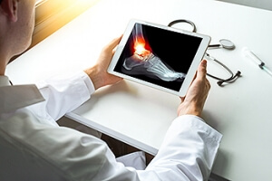 Common Ways to Break an Ankle