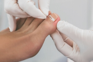 Treatment Options for Ingrown Toenails