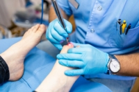 Pros and Cons of Laser Toenail Treatment